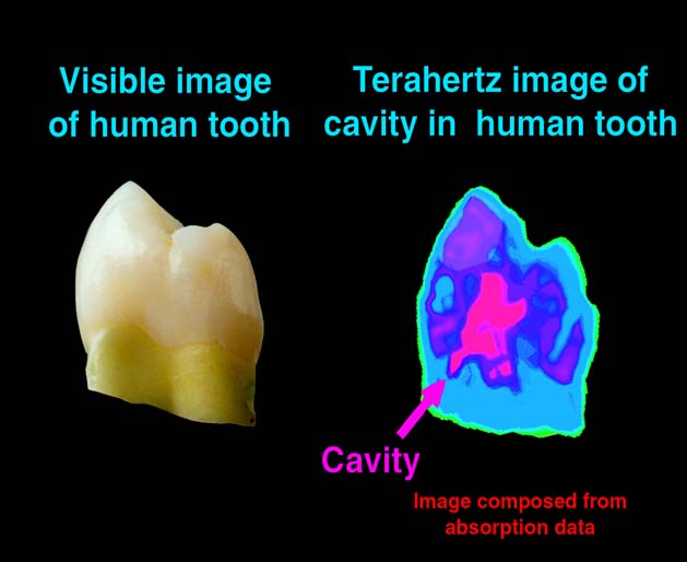 Terahertz sugárz rzás s alkalmazása repülő téri biztonsági ellenőrzés orvosi képalkotás gyors adatátviteli rendszerek (Tb/s