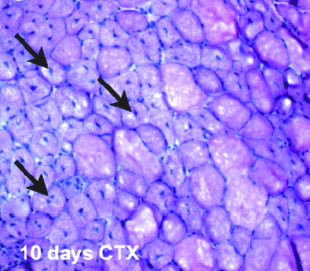 Izomsérülés: a sarcolemmal és sarcoplazmatikus reticulum sérülésének következtében megnő a Ca 2+ influx megindul a az izomdegeneráció, amit fehérvérsejtek bevándorlása követ: 1/ 1-6 óra neutrophil