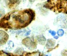 10.ábra Mycophenolát mofetil (mycophenolsav MPA 6x100mg/tskg/hét)) illetve rapamune (rapamycin 5x3mg/tskg/hét) kezelés gátolja a KMH2, Hodgkin lymphoma xenograft tumor növekedését tumor térfogat