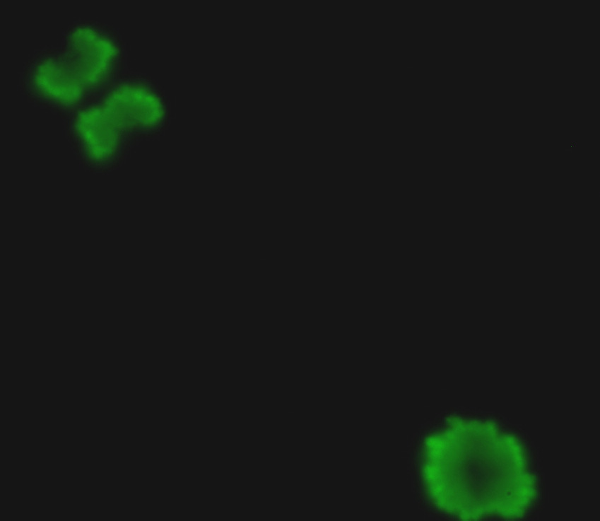 14.ábra Előbbi HE, ps6 és phh3 festett cytospin lemezek kiértékelésének ábrázolása 14% 12% 10% 8% 6% 4% Mitotic cells in HE p-histone H3+ cells High p-s6+ cells 2% 0% Control Nocodasole Fluoreszcens