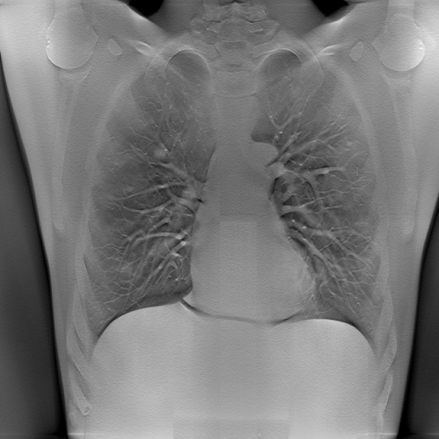 röntgen emlő MRI mellkas CT BME-MIT 2013