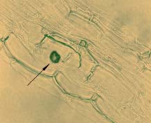 apoptotikus folyamatokra utaló, jellegzetes morfológiájú sejtmagokat észlelnünk (71. ábra). A B 71. ábra D.