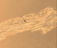 szemikarbazid mentes folyékony MS alaptápközegen nevelt hairy root-ok felépítésétol sem a sötétben, sem pedig a fényen történt tenyésztés után (111. és 112. ábrák).