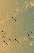innoxia in vitro növények gyökereibol készült metszetek, HE festést követoen (A: 2x os nagyítás; a: rhizodermisz, b: kéregparenchima, e: fanyalá bok, f: háncsnyalábok; B: 4x os nagyítás; nyilak: