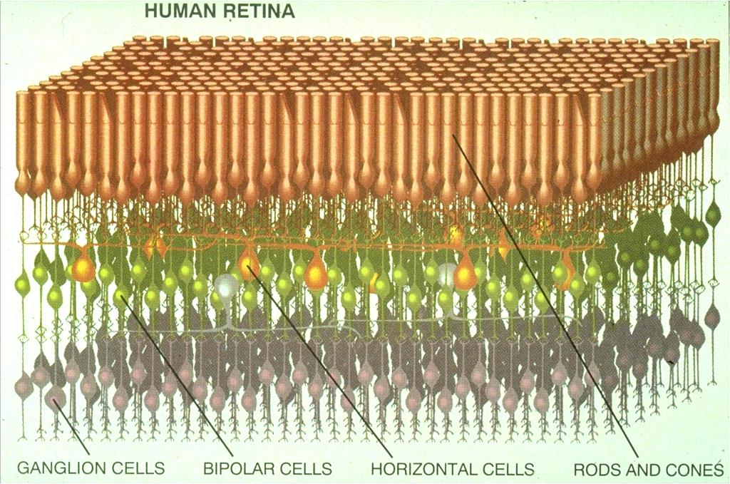 A retina