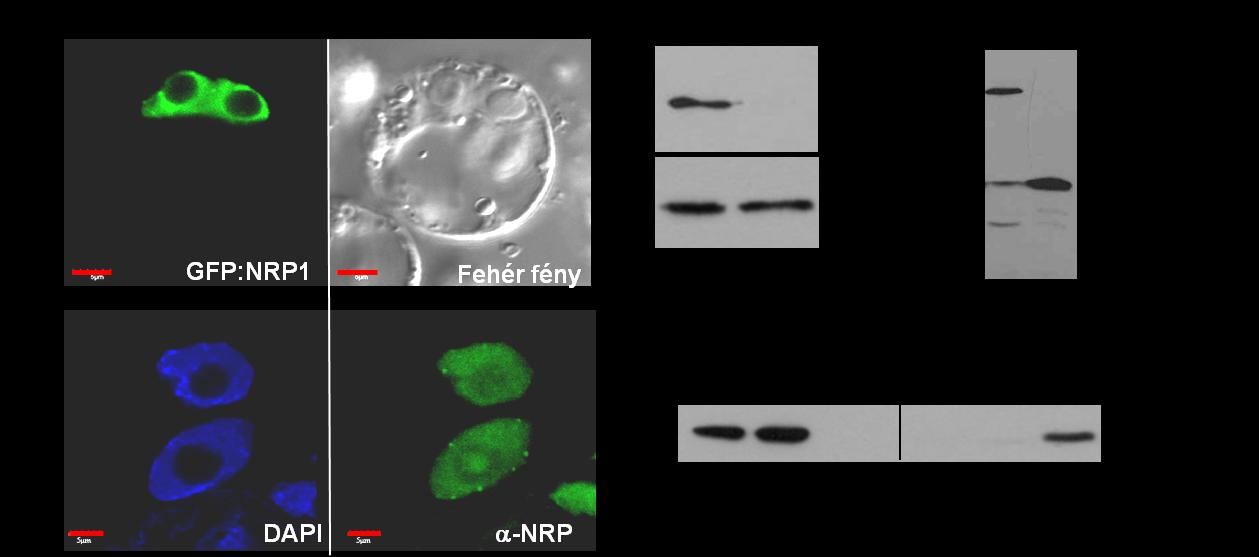 18. ábra. Az NRP fehérjék előfordulása a sejten belül különböző módszerekkel a. A lúdfű transzformált protoplasztokban a GFP-hez kötött NRP1 (GFP:NRP1) a sejtmagban lokalizálódik.