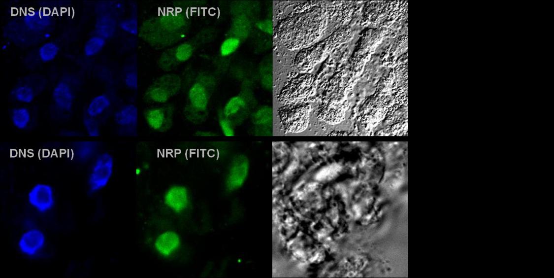 használt feltáró pufferben lévő detergensek ily módon hozzájárulhattak ahhoz, hogy immunoblot kísérletünkben a citoplazmát tartalmazó frakcióba kerültek az NRP fehérjék.