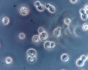 Anti-neutrofil citoplazmatikus antitest (ANCA) Kimutatás: ELISA és IIF módszerek ELISA alapján: anti-pr3 és anti-mpo antitestek IIF alapján: S.