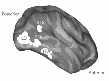 Az arcfelismerésben szerepet játszó legfontosabb agyterületek elhelyezkedése a jobb féltekén. A kép az agyat ún. felfújt állapotban mutatja a jobb láthatóság miatt.