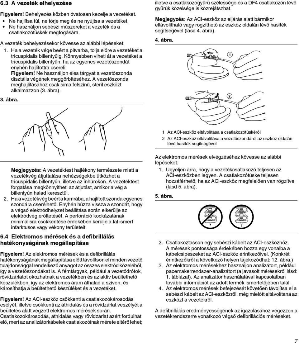 Ha a vezeték vége beért a pitvarba, tolja előre a vezetéket a tricuspidalis billentyűig.