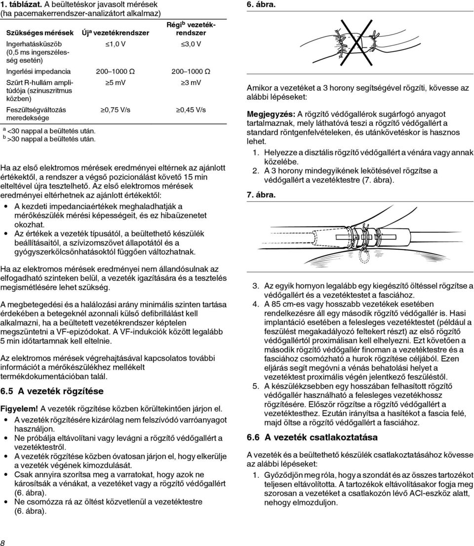 Ingerlési impedancia 200 1000 Ω 200 1000 Ω Szűrt R-hullám amplitúdója (szinuszritmus közben) Feszültségváltozás meredeksége a <30 nappal a beültetés után. b >30 nappal a beültetés után.