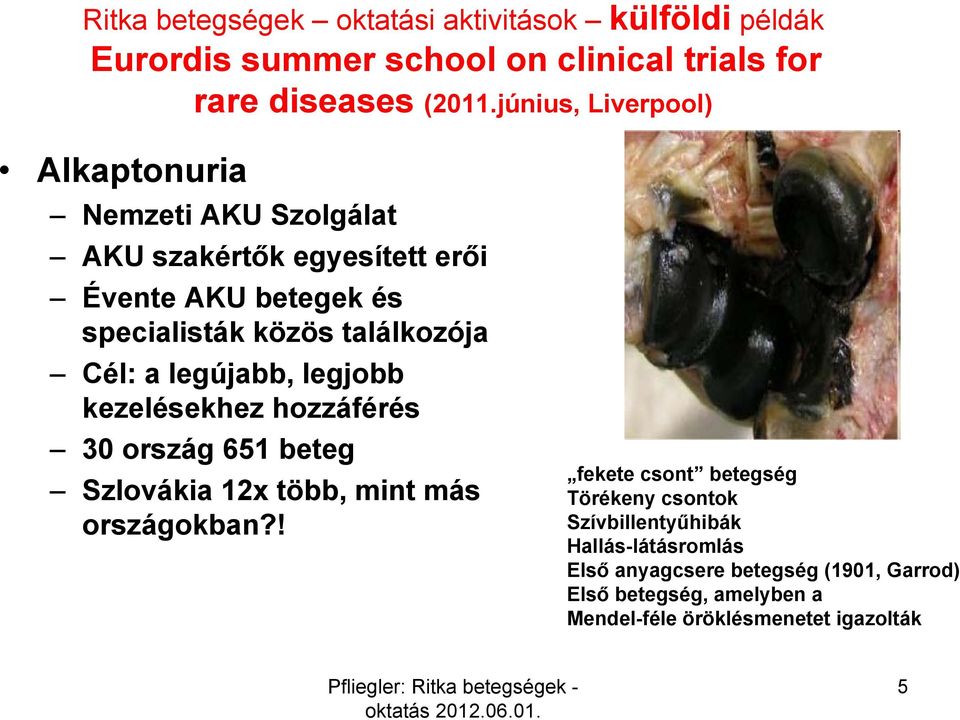 Cél: a legújabb, legjobb kezelésekhez hozzáférés 30 ország 651 beteg Szlovákia 12x több, mint más országokban?