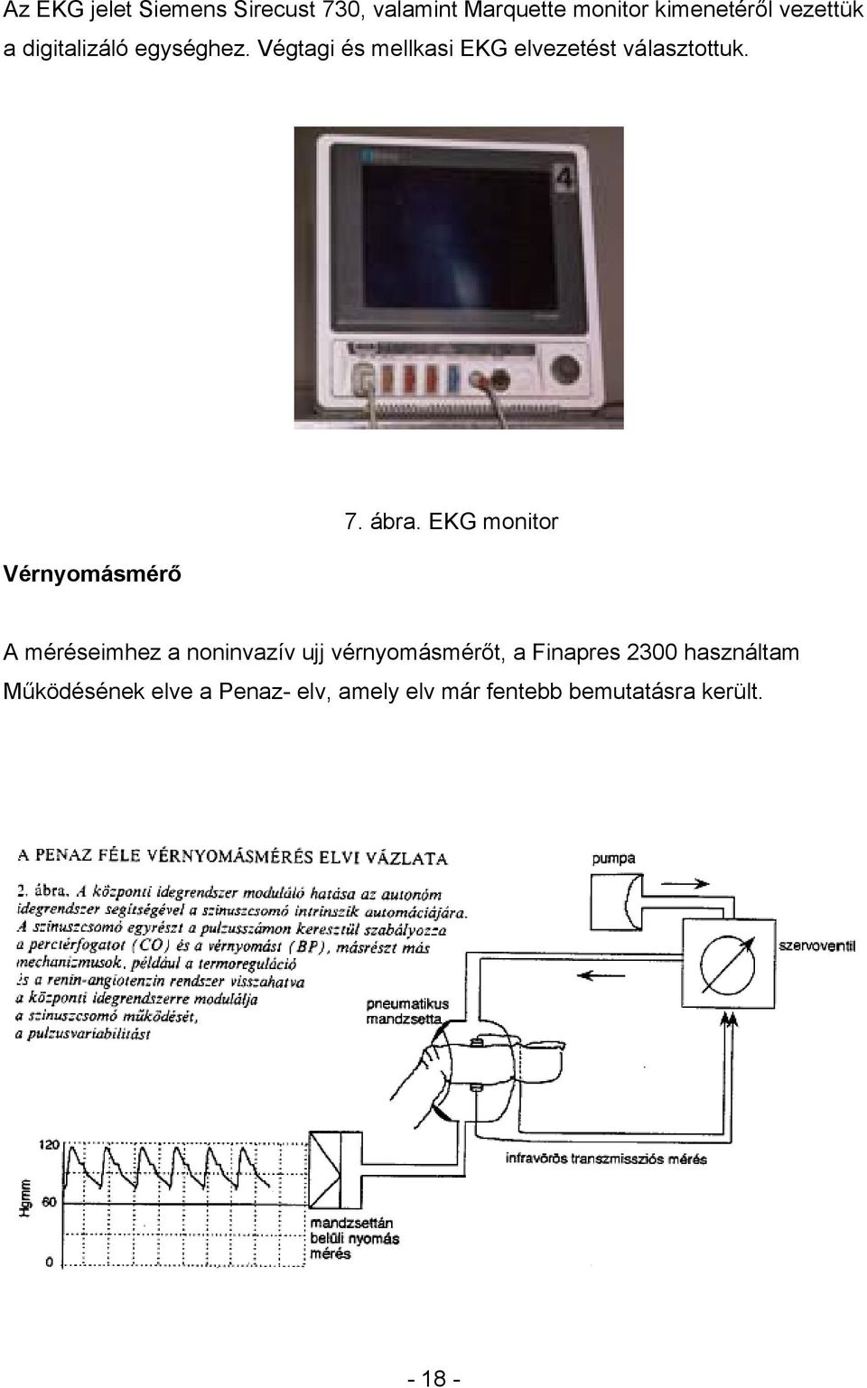 Vérnyomásmérő 7. ábra.