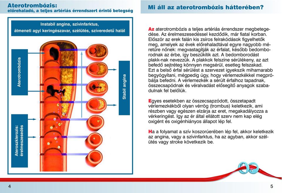 megbetegedése. Az érelmeszesedéssel kezdôdik, már fiatal korban.