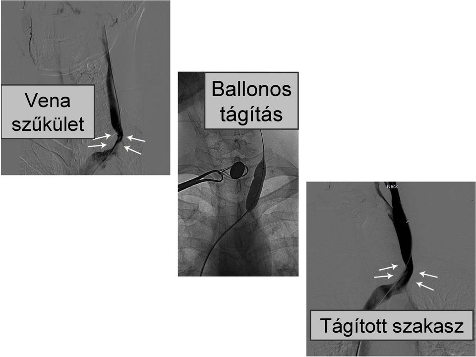 Ballonos