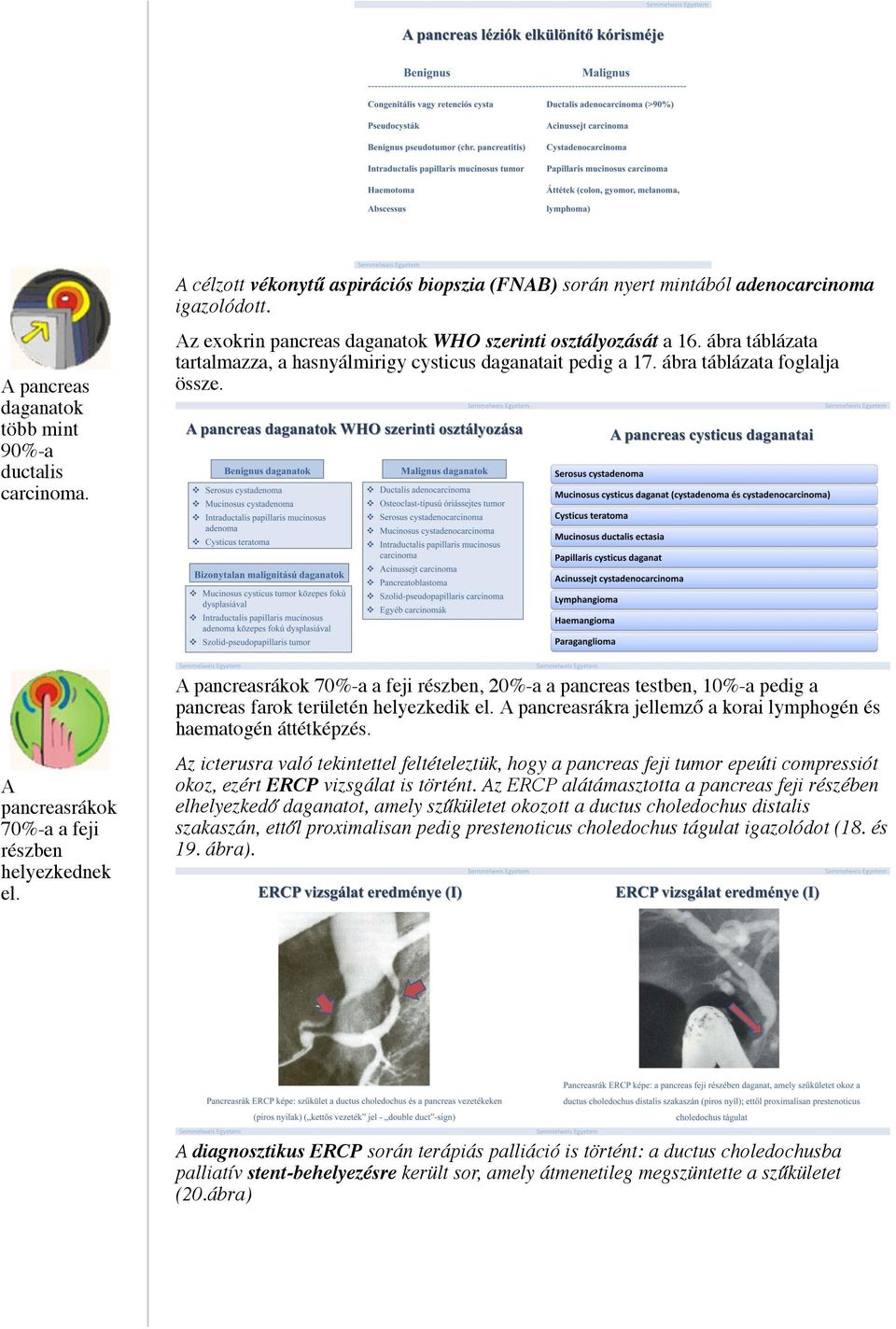 A pancreasrákok 70%-a a feji részben, 20%-a a pancreas testben, 10%-a pedig a pancreas farok területén helyezkedik el. A pancreasrákra jellemző a korai lymphogén és haematogén áttétképzés.