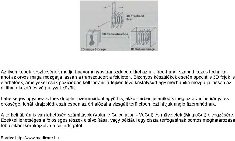 Lehetséges ugyanez színes doppler üzemmóddal együtt is, ekkor térben jelenítődik meg az áramlás iránya és erőssége, tehát kirajzolódik színesben az érhálózat a vizsgált területben, ezt hívjuk angio