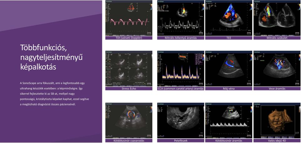 Így Stress Echo CCA ( common carotid artery) áramlás Máj véna Vese áramlás sikerrel fejlesztette ki az S8-at, mellyel nagy