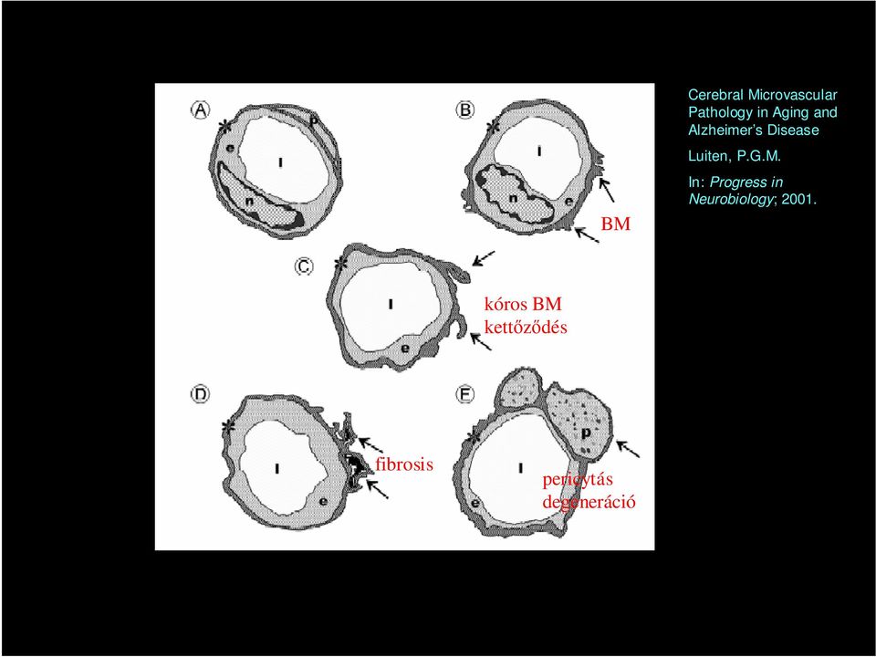 M. In: Progress in Neurobiology; 2001.