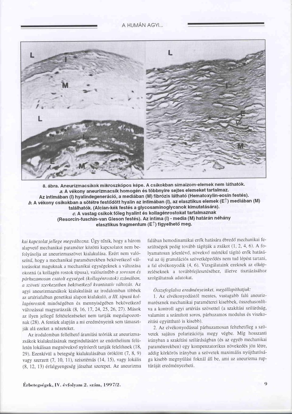 A v6kony csikokban a sötltre festddött hyalin az intimäban (l), az elasztikus elemek (ET) mediäban (M) talälhat6k. (Alcian-k6k fest6s a glycosam inoglycanok kimutatäsära)' c.