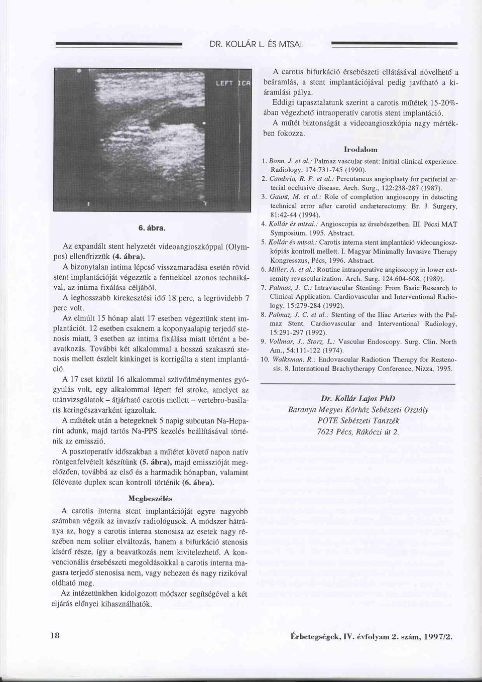 Az expandält stent helyzet6t videoangioszkdppal (Olympos) ellendrizznk @. äbra).