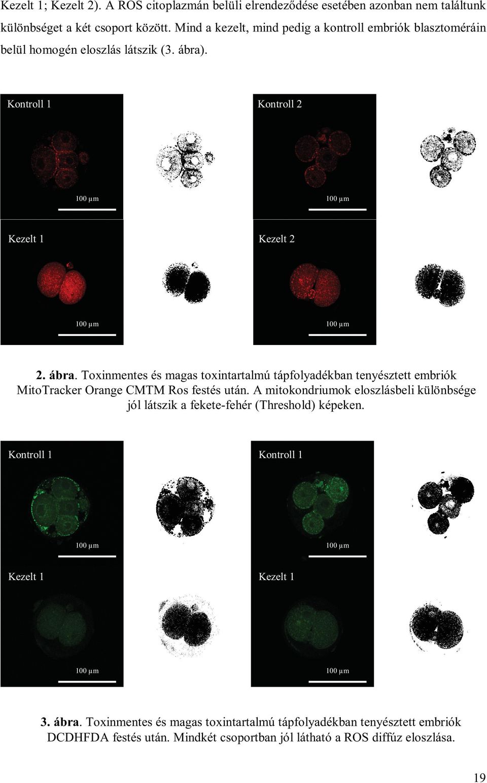 . Kontroll 1 Kontroll 2 100 µm 100 µm Kezelt 1 Kezelt 2 100 µm 100 µm 2. ábra.