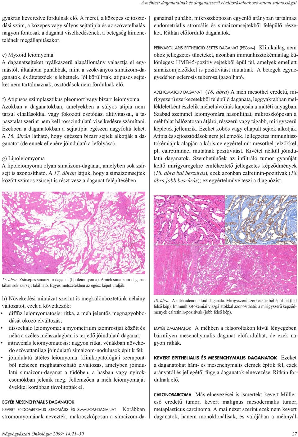 e) Myxoid leiomyoma A daganatsejteket nyálkaszerû alapállomány választja el egymástól, általában puhábbak, mint a szokványos simaizom-daganatok, és áttetszôek is lehetnek.
