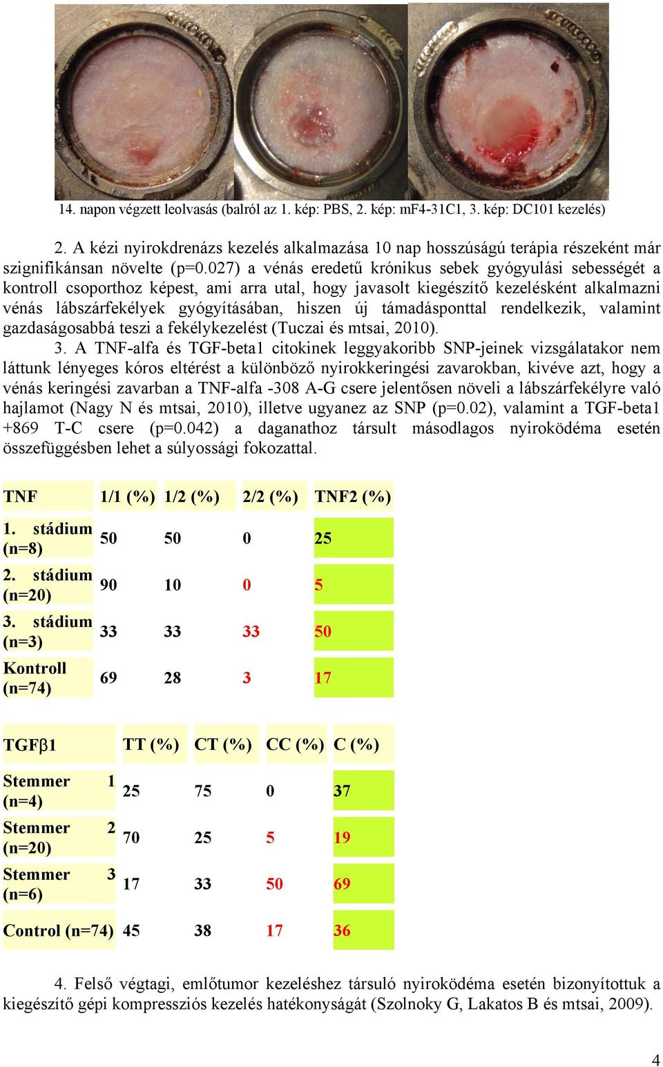 027) a vénás eredetű krónikus sebek gyógyulási sebességét a kontroll csoporthoz képest, ami arra utal, hogy javasolt kiegészítő kezelésként alkalmazni vénás lábszárfekélyek gyógyításában, hiszen új