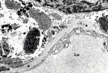 4 4. ábra. A dermális nyirokkapilláris lumene (Lu) tágult. A kapillárist körülvevı kötıszöveti szegélyben szabálytalan lefutású mikrofilamentumok vannak (csillagok). Horgonyzó rostok nincsenek.