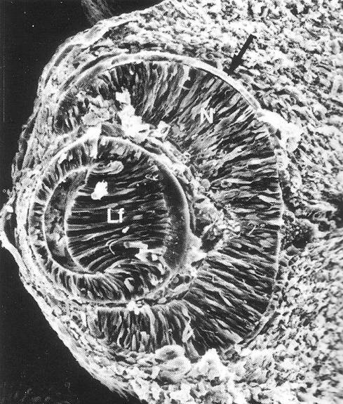 2.1. A szemlencsével kapcsolatos fejlődéstani, anatómiai és szövettani ismeretek 2.1.1. A szemlencse fejlődéstana A szemlencse (lens crystallina) fejlődése akkor kezdődik, mikor a szemhólyag a kétsoros ectodermával kontaktusba kerül.