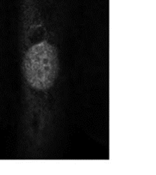 7. 5. ábra. TIMAP fehérje csendesítése HPAEC sejtekben. A panel: TIMAP fehérje expressziós szintjének változása Western blot kísérletben.