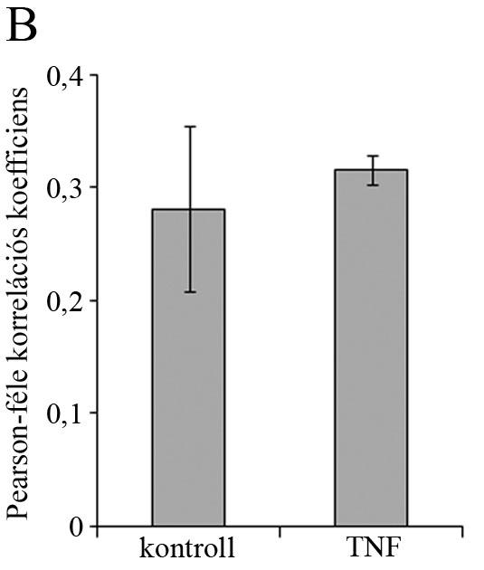 A 9. ábra: A TNF nem csökkenti a Golgi apparátusban lévő CD3ζ mennyiségét.