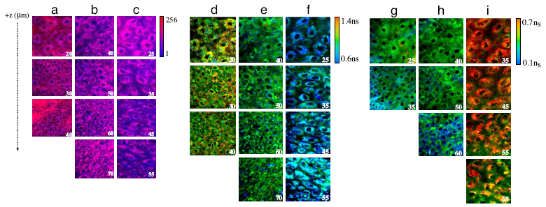 9. ábra In vivo 3 dimenziós többfotonos FLIM felvételek a szövetek diagnosztizálására: (a-c) redox arány; (d-f) átlagos NADH életidő; (g-i) átlagos FAD életidő.