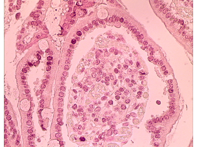 A poli (ADP) ribózt a vékonybél biopsziás mintákból immunhisztokémiai módszerrel mutattuk ki. A cardiopulmonaris bypass kezdetén vett biopsziákban nem volt kimutatható a PAR.