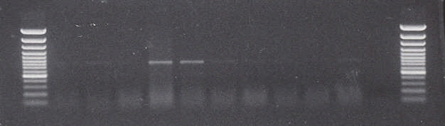 17 A. 500 B. 500 M 1 2 3 4 5 6 7 8 9 10 11 9. ábra: Az ACO-F és ACO-R primerpárral RT-PCR-el felszaporított fragmentumok. A.: 25 PCR ciklus, B.: 35 PCR ciklus 1., 2,. 3,. 4. minták: zöld, fehér, rózsaszín, piros érési stádiumban levő gyümölcshús, 5.
