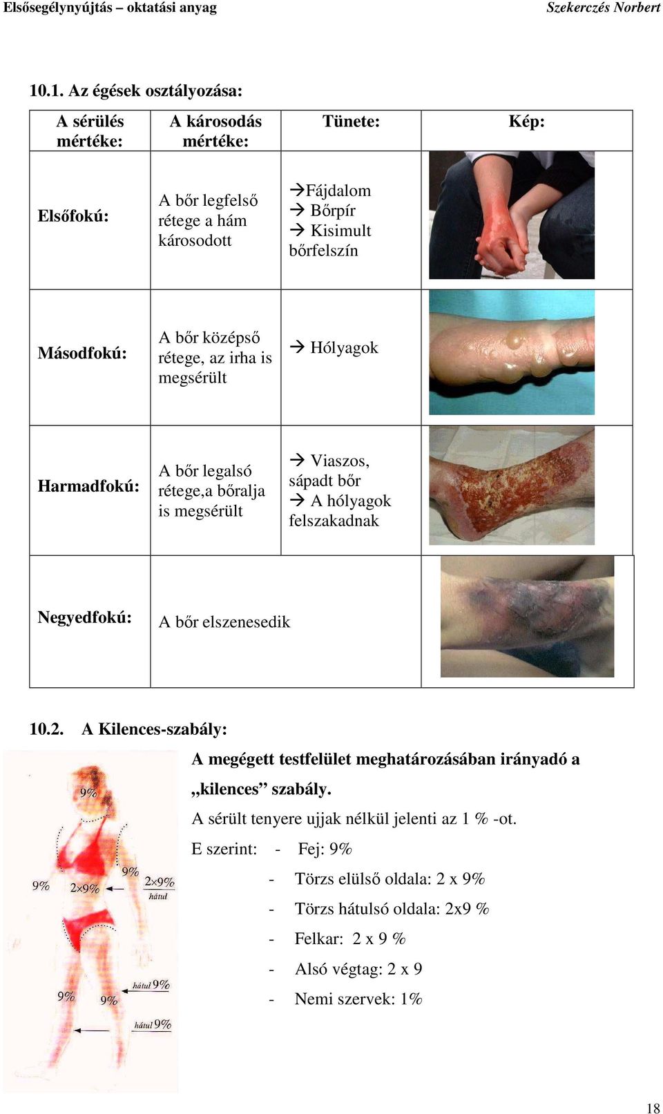 felszakadnak Negyedfokú: A bır elszenesedik 10.2. A Kilences-szabály: A megégett testfelület meghatározásában irányadó a kilences szabály.