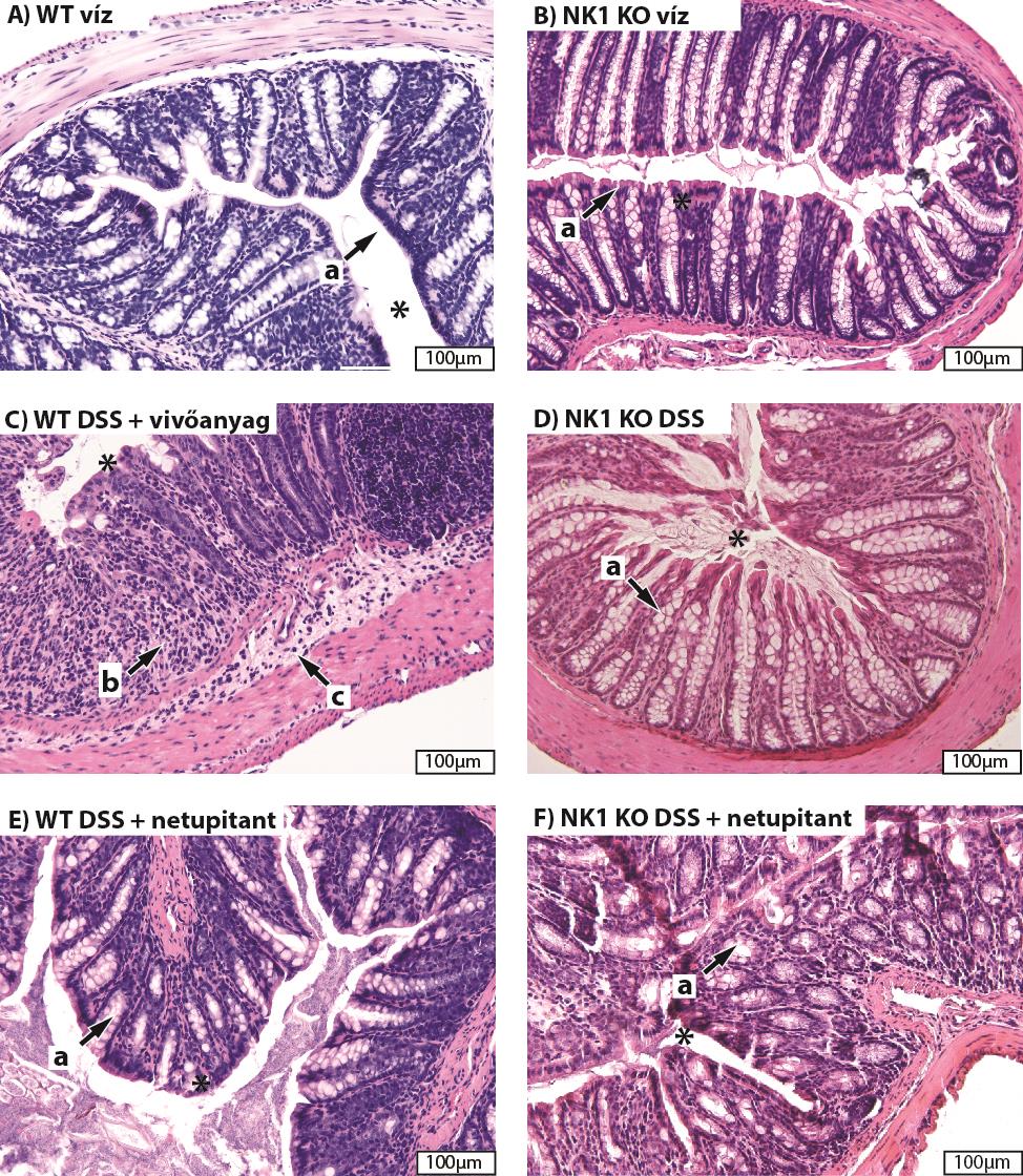 29. ábra A-F) DSS indukálta colitis szövettani metszetei NK1 receptor hiányos és netupitant kezelt állatokban Disztális colon szegmensek 200-szoros nagyításban, hematoxilin-eozin festéssel.