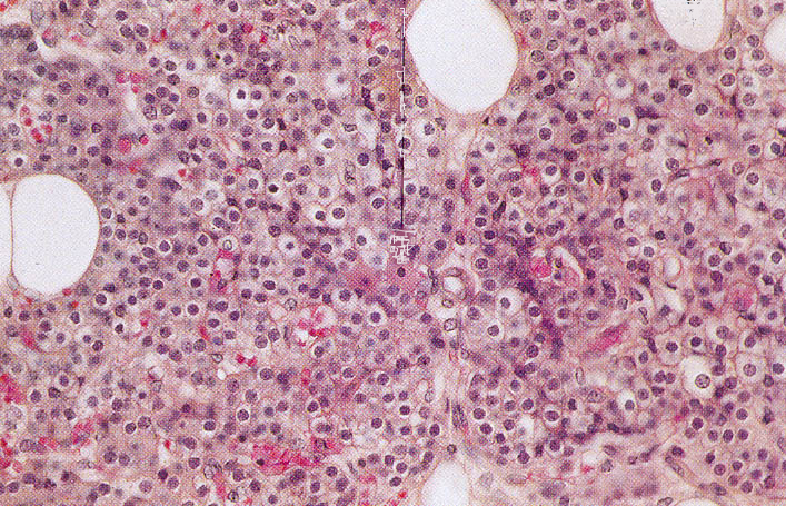 Mellékpajzsmirigy glandula parathyroidea epitheltestecske calcium és s foszfor anyagcserét t szabályozza Hormonja: