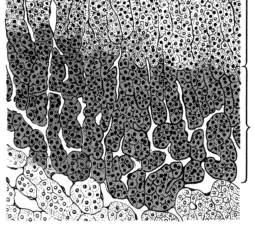 epithel sejtfészkek szkek polygonalis sejtek oszlopokban hálózatosan elrendezıdött acidofil CAPSULA MELLÉKVESEK KVESEKÉREG ZONA GLOMERULOSA Na + retencio K + kiválasztás ZONA FASCICULATA ZONA