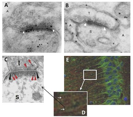 Glia-neuron interakció Metabolikus együttműködés A: electron micrograph showing double immunogold labeling at synapses between parallel fiber terminals (T) and Purkinje cell spines (S).