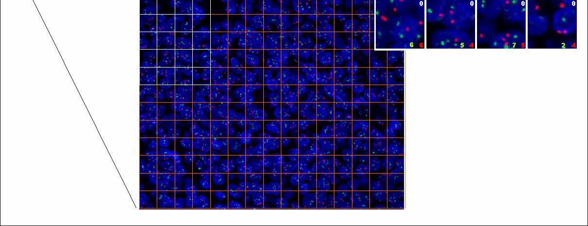 4. ábra Rácsos mintavétel. Miután az automatizált rendszer rögzítette a látómezırıl öt különbözı fókuszsíkban felvett képeket, egy 15 x 12 cellából álló ráccsal fedte le a teljes képet.
