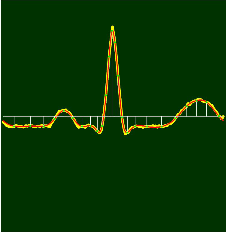 HIPERBOLIKUS WAVELETEK 29 A T N halmaz A θ N