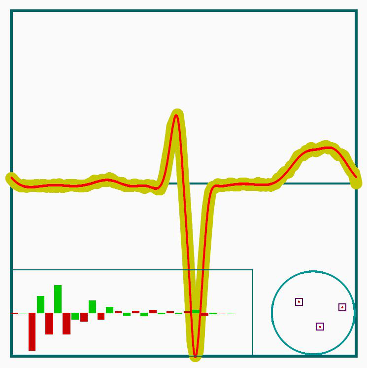 34 SCHIPP FERENC Az MT-rendszer pólusai Az EKG-jel approximációja EKG-jel két elvezetésének közelítése Hivatkozások [1] Alexits, G.: Convergence problems of orthogonal functions.