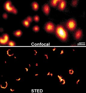 Strukturált megvilágításos mikroszkóp Strukturált megvilágításos mikroszkóp Hagyományos (bal) és strukturált megvilágításos mikroszkópi kép (jobb) idegsejtekről.