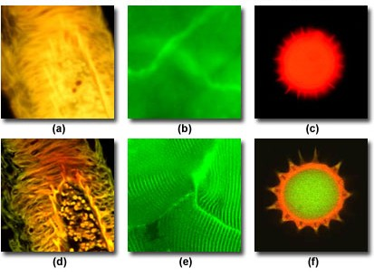Objektívek numerikus apertúrája Fluoreszcencia mikroszkóp A konfokális fluoreszcencia mikroszkóp működése