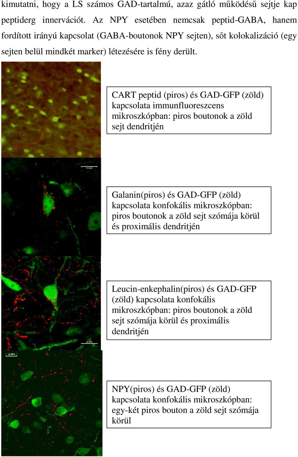 CART peptid (piros) és GAD-GFP (zöld) kapcsolata immunfluoreszcens mikroszkópban: piros boutonok a zöld sejt dendritjén Galanin(piros) és GAD-GFP (zöld) kapcsolata konfokális mikroszkópban: piros