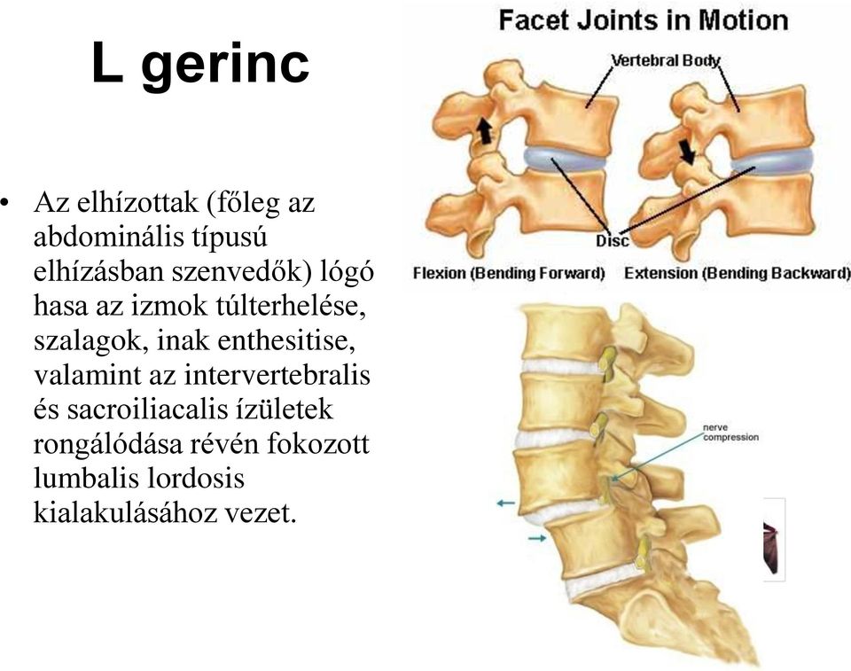 enthesitise, valamint az intervertebralis és sacroiliacalis