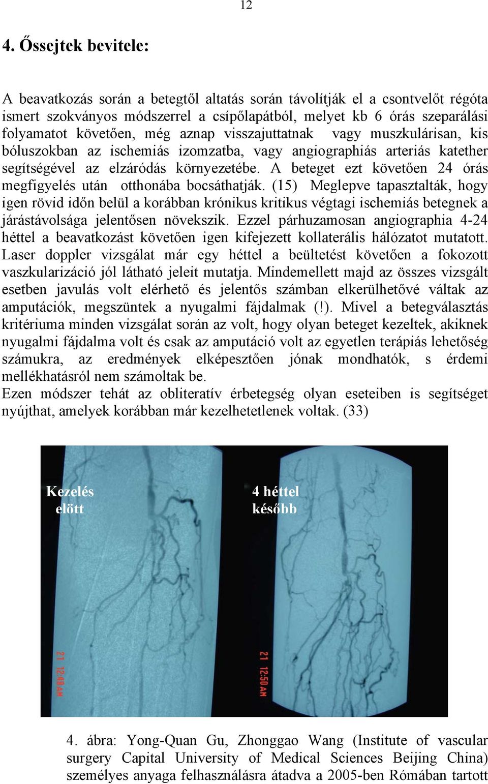 A beteget ezt követően 24 órás megfigyelés után otthonába bocsáthatják.