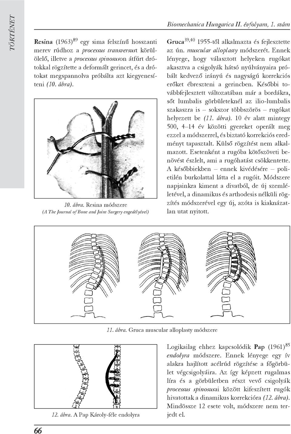 szám Gruca 39,40 1955-tõl alkalmazta és fejlesztette az ún. muscular alloplasty módszerét.