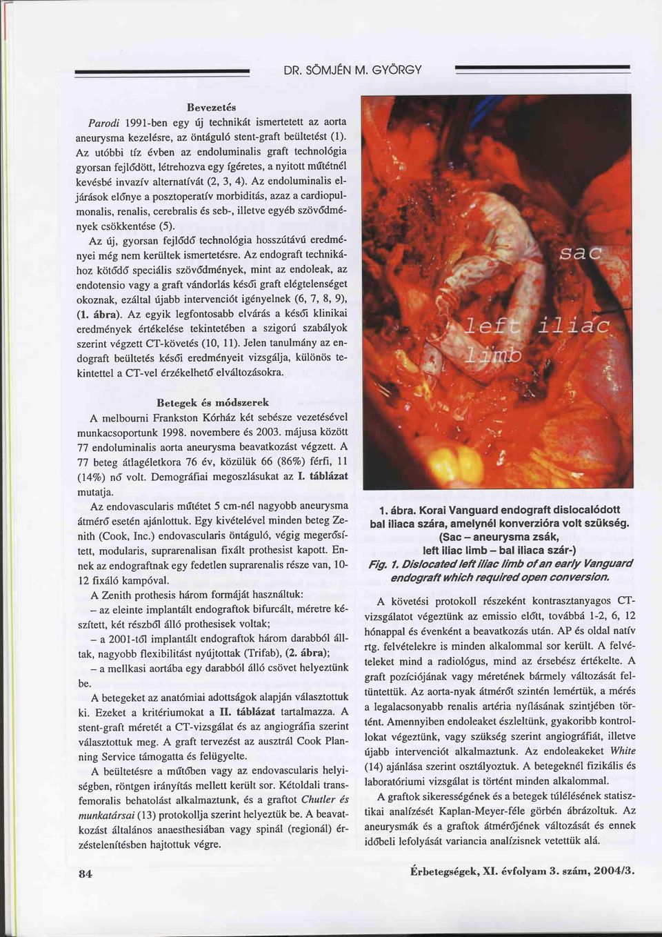 Az endoluminalis eljäräsok eldnye a posztoperativ morbiditäs, azaz a cardiopulmonalis, renalis, cerebralis 6s seb-, illetve egy6b szövddm6- nyek csökkentdse (5).